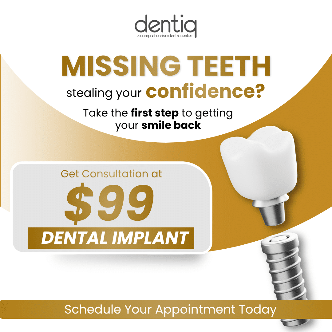 $99 All-on-4 implant consultation — Dentiq Dentistry Houston