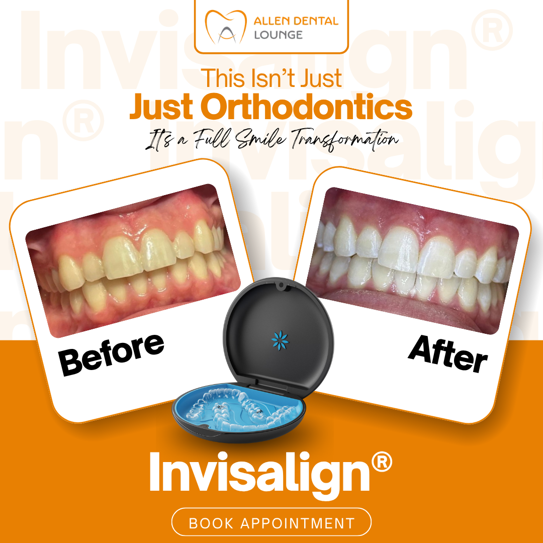 Invisalign before and after — Allen Dental Lounge patient results