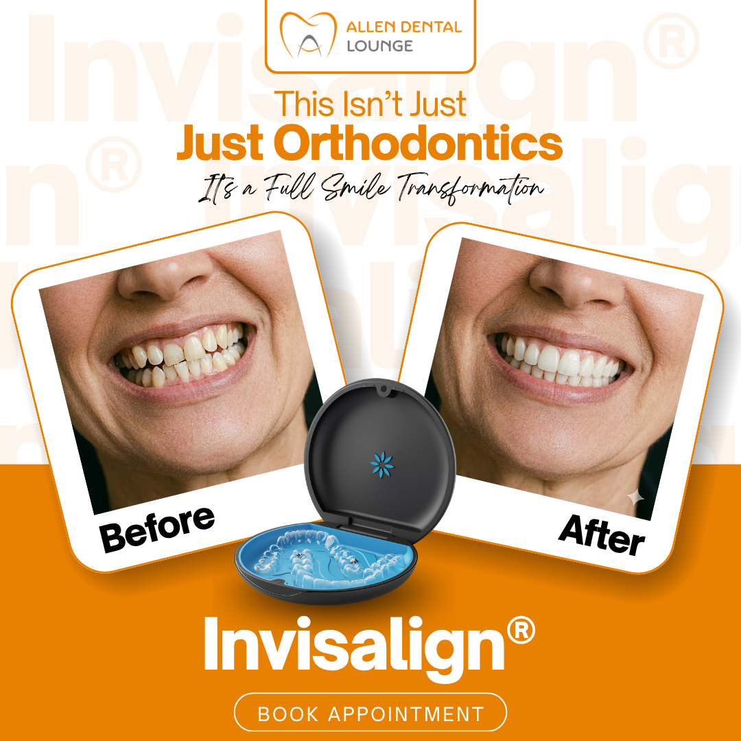 Invisalign before and after — Allen Dental Lounge patient results