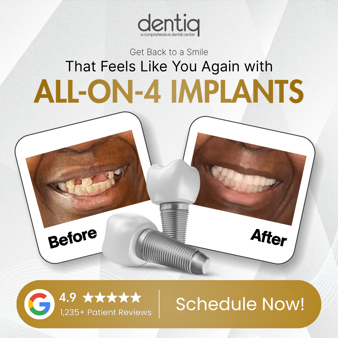 Dental implant before and after — Dentiq Dentistry Houston